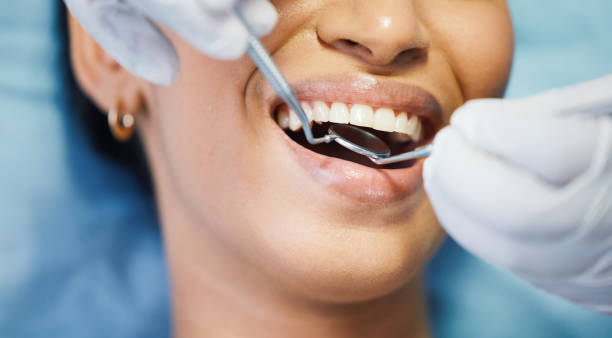 Best Emergency Gum Treatment in Riverton, IL