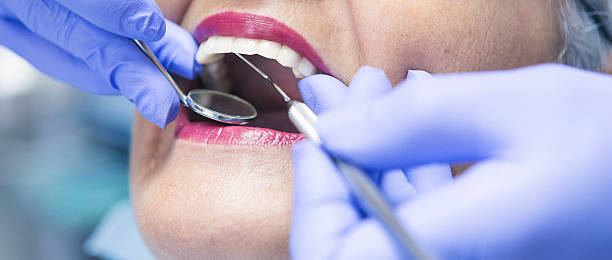 Best Emergency Gum Treatment in Riverton, IL